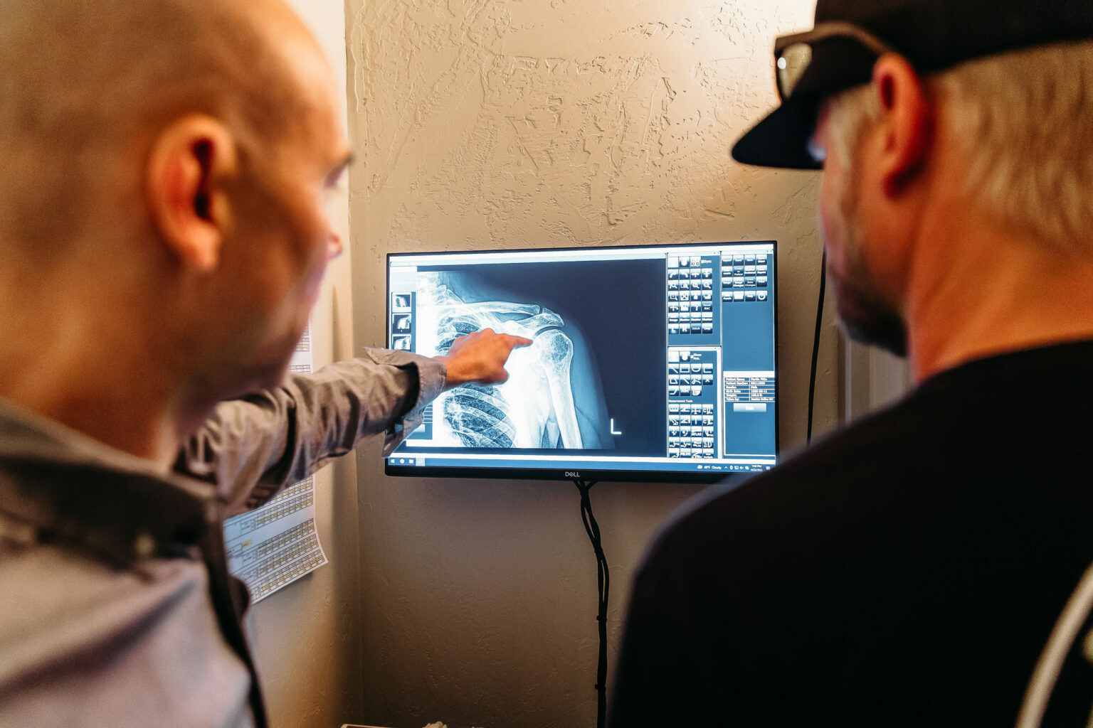 ACL Injury - Balance Medical Integration